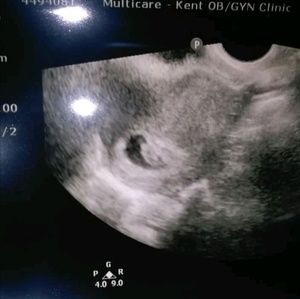 Meet your Posher, Clara